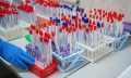 Могилевчан приглашают пройти бесплатное тестирование на антитела к коронавирусу