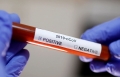 ВОЗ передала в Беларусь наборы для проведения 6 тыс. тестов на коронавирус